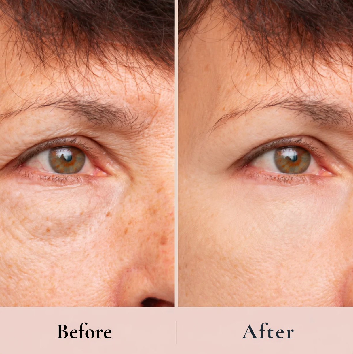 The Peptide Collagen Hydrogel Eye Patch™