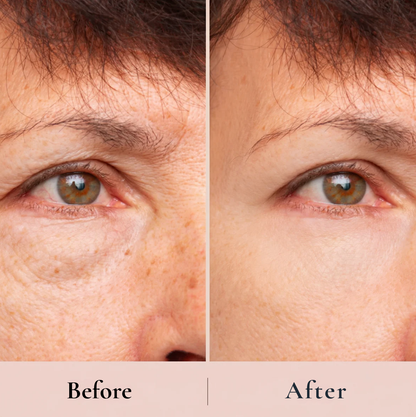 The Peptide Collagen Hydrogel Eye Patch™