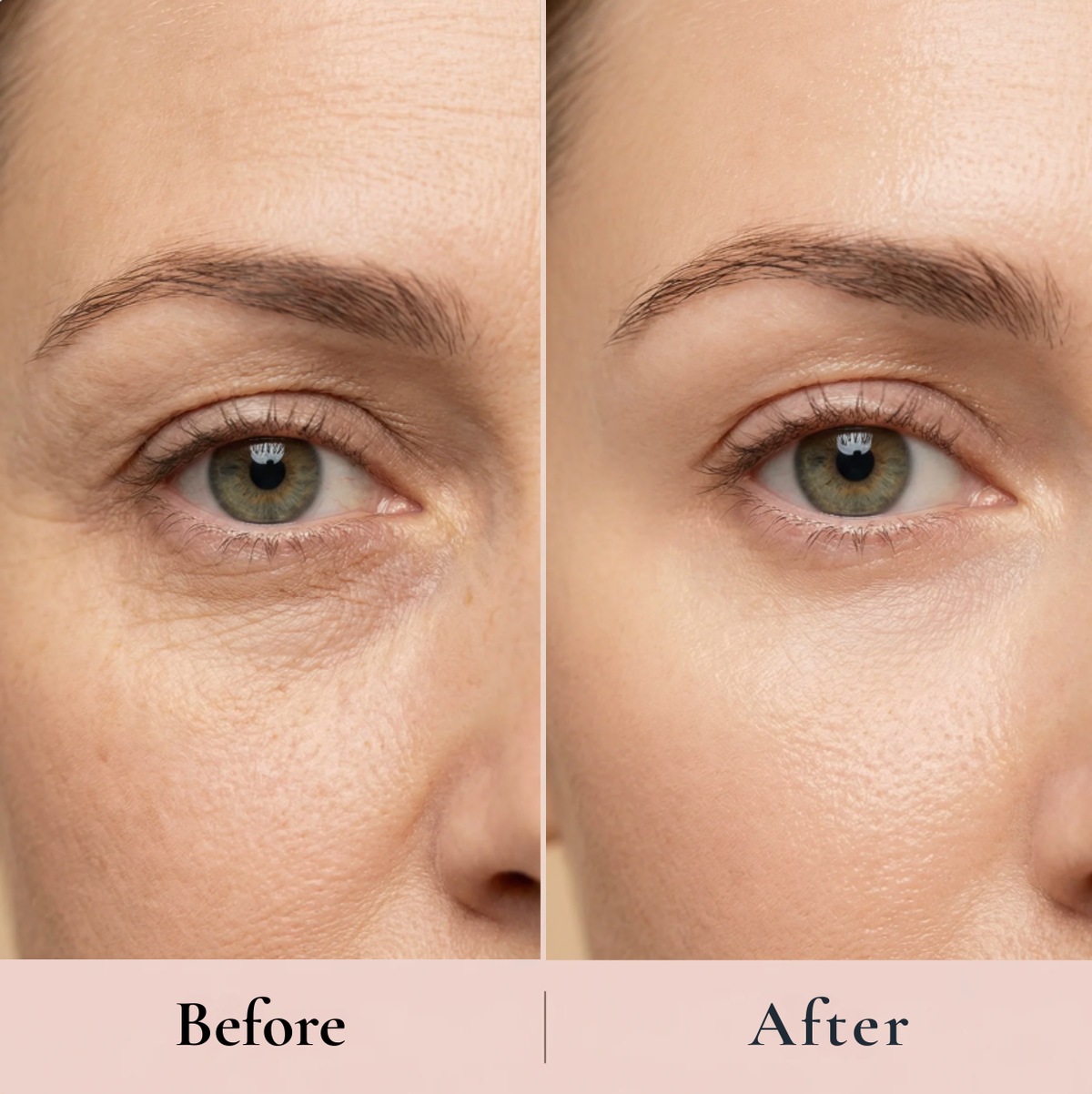The Peptide Collagen Hydrogel Eye Patch™
