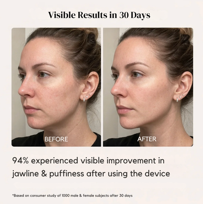 LumiLift™ Microcurrent V-Shape Facial Massager