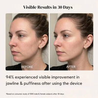 LumiLift™ Microcurrent V-Shape Facial Massager